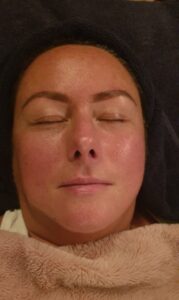 Facial Reflexology